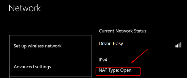 Тип Nat на Xbox. Set net 1